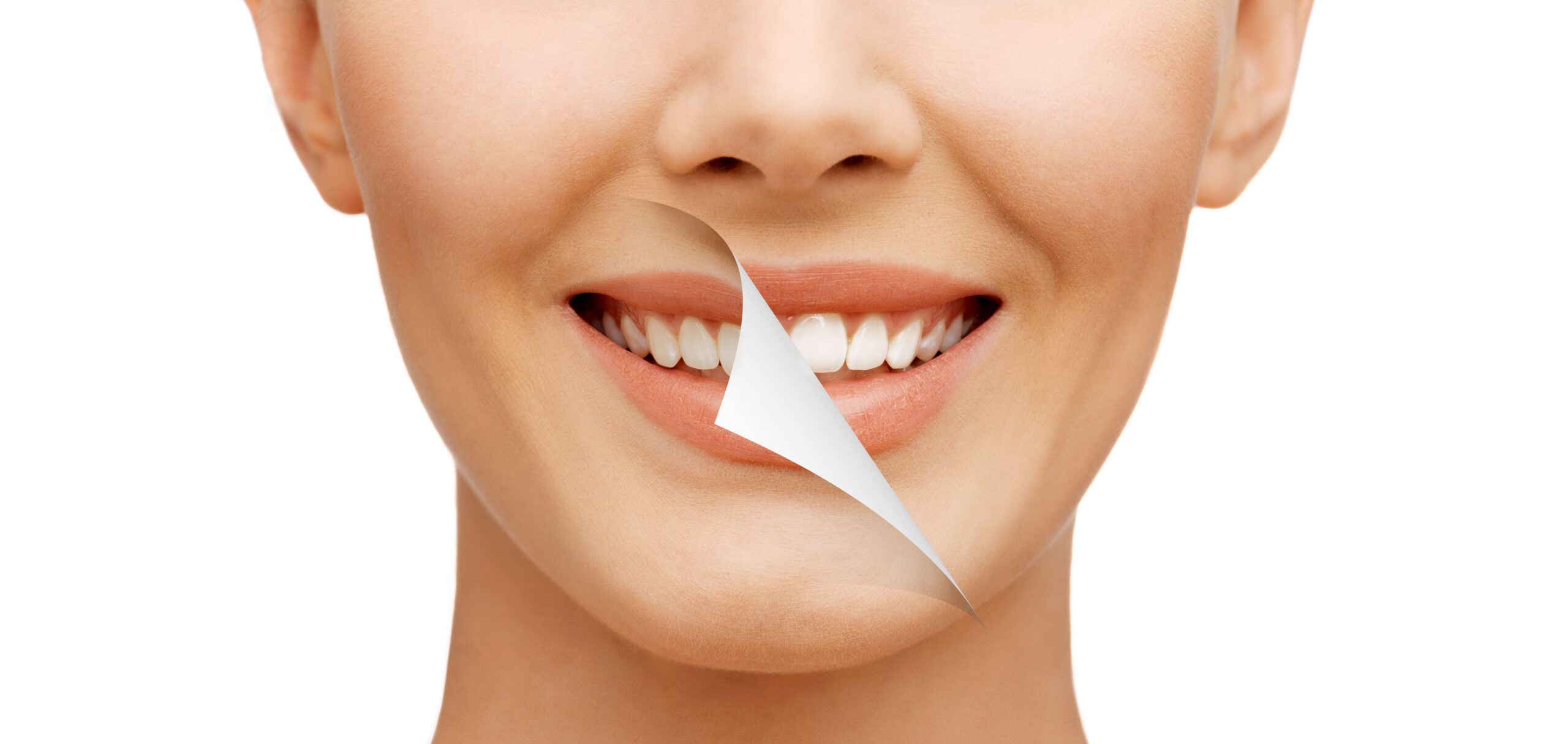 new-smile-min